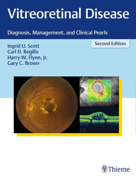 Produktbild: Vitreoretinal Disease