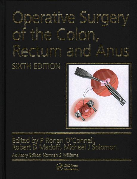 Produktbild: Operative Surgery of the Colon, Rectum and Anus