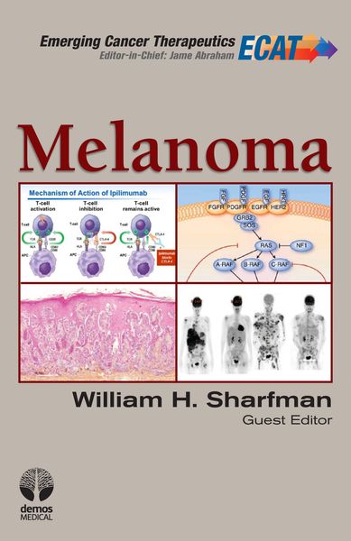 Produktbild: Melanoma