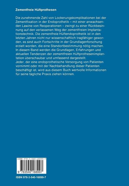 Produktbild: Zementfreie H&uuml;ftprothesen