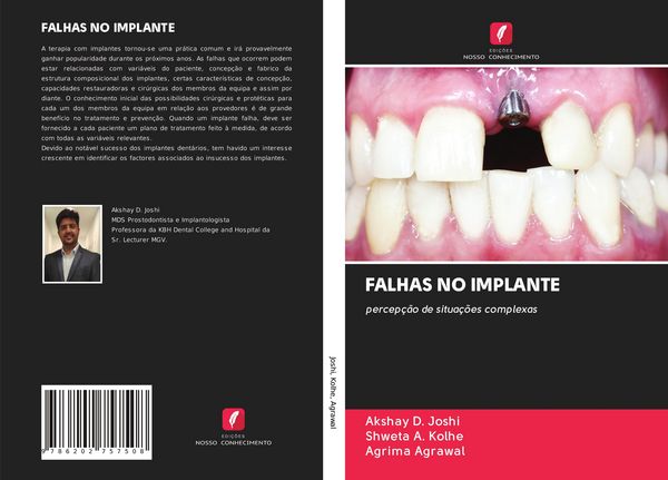 Produktbild: Falhas No Implante