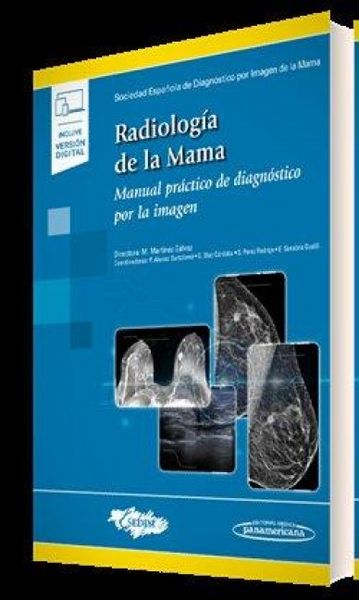 Produktbild: Tratado De Radiologia De La Mama