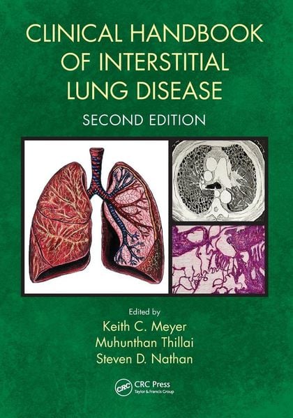 Produktbild: Clinical Handbook of Interstitial Lung Disease