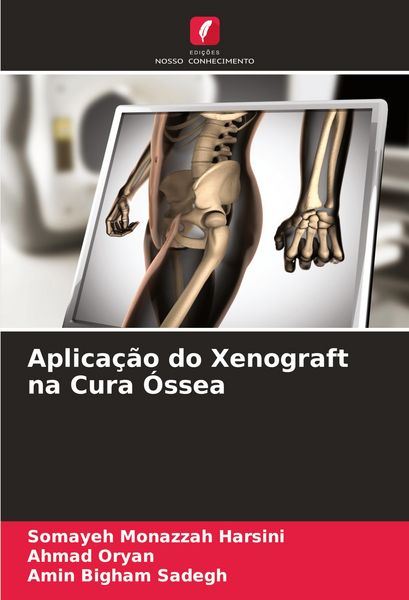 Produktbild: Aplica&ccedil;&atilde;o do Xenograft na Cura &Oacute;ssea