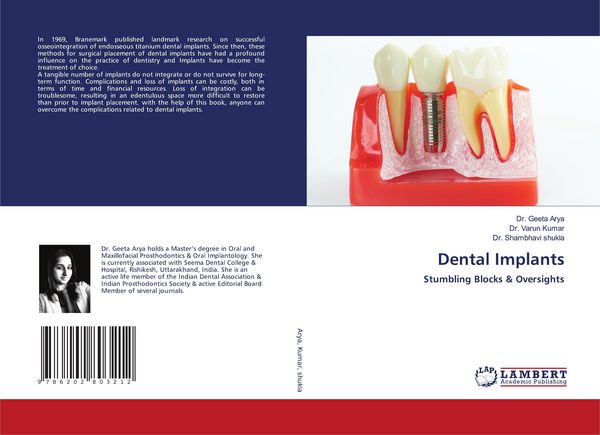Produktbild: Dental Implants