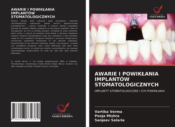 Produktbild: AWARIE I POWIK&iquest;ANIA IMPLANT&Oacute;W STOMATOLOGICZNYCH