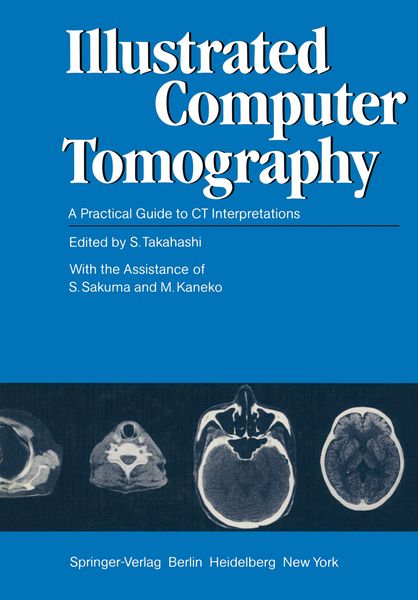 Produktbild: Illustrated Computer Tomography