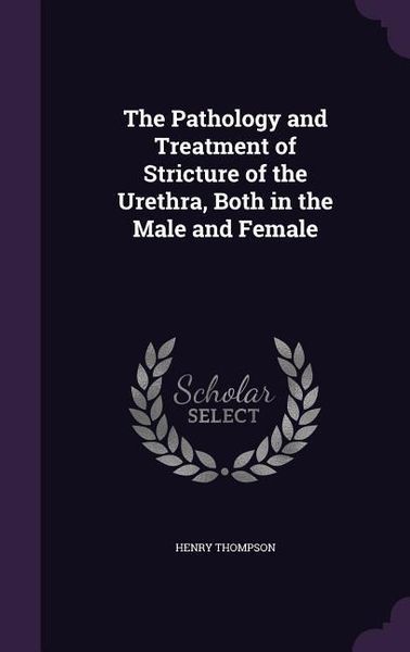 Produktbild: The Pathology and Treatment of Stricture of the Urethra, Both in the Male and Female