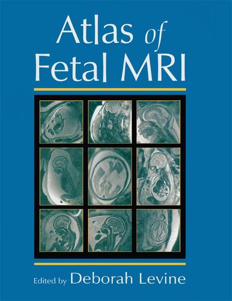 Produktbild: Atlas of Fetal MRI