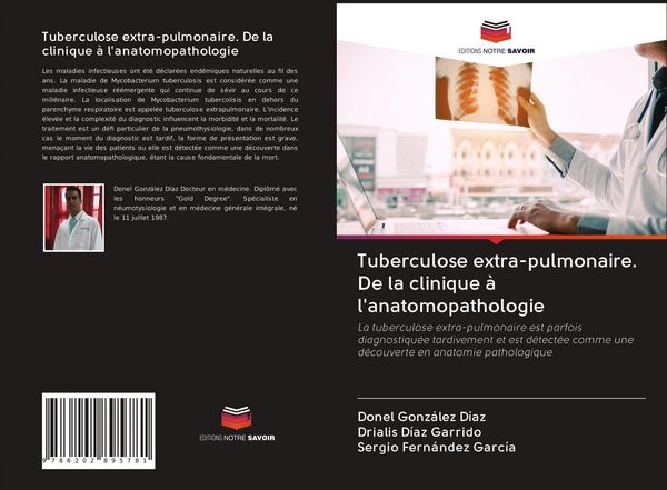 Produktbild: Tuberculose extra-pulmonaire. De la clinique &agrave; l'anatomopathologie