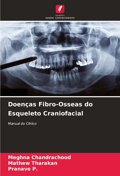 Produktbild: Doen&ccedil;as Fibro-Osseas do Esqueleto Craniofacial