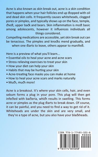 Produktbild: Acne