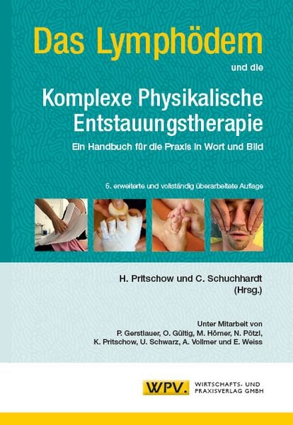 Produktbild: Das Lymph&ouml;dem und die Komplexe Physikalische Entstauungstherapie