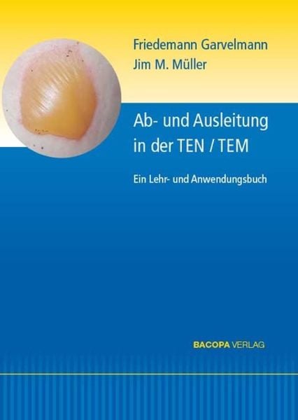 Produktbild: Ab- und Ausleitungsverfahren in der TEN/TEM.