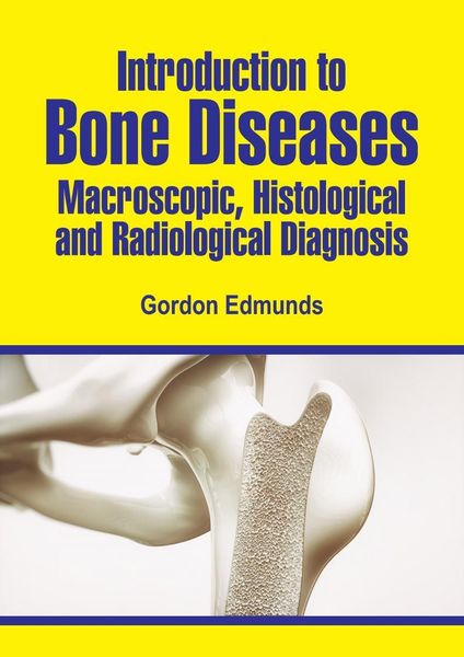 Produktbild: Introduction to Bone Diseases