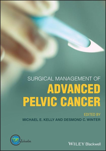 Produktbild: Surgical Management of Advanced Pelvic Cancer