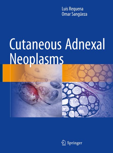 Produktbild: Cutaneous Adnexal Neoplasms