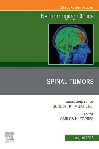 Produktbild: Spinal Tumors, An Issue of Neuroimaging Clinics of North America, E-Book