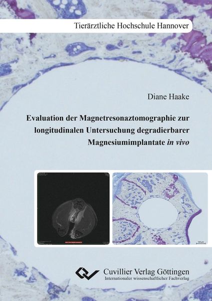 Produktbild: Evaluation der Magnetresonaztomographie zur longitudinalen Untersuchung degradierbarer Mag-nesiumimplantate in vivo
