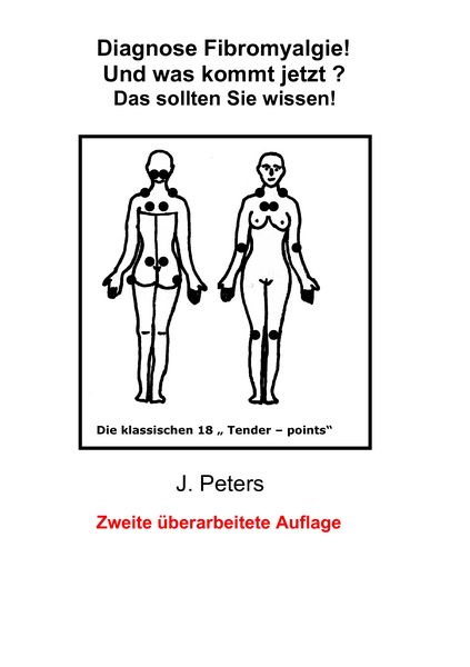 Produktbild: Diagnose Fibromyalgie! Und was kommt jetzt?