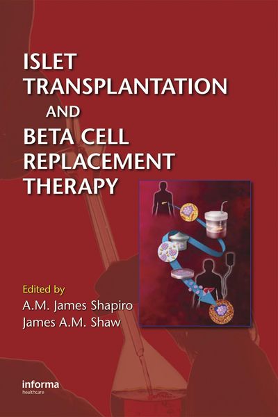 Produktbild: Islet Transplantation and Beta Cell Replacement Therapy