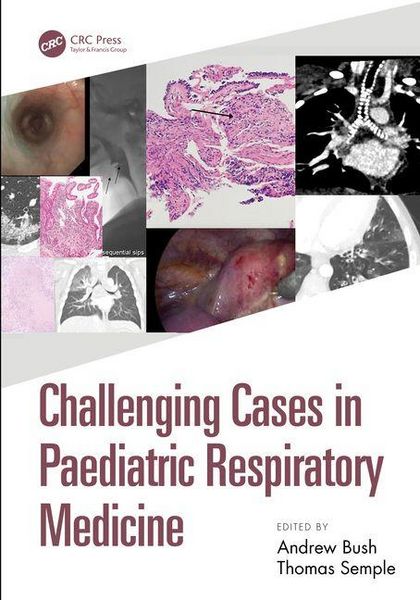 Produktbild: Challenging Cases in Paediatric Respiratory Medicine