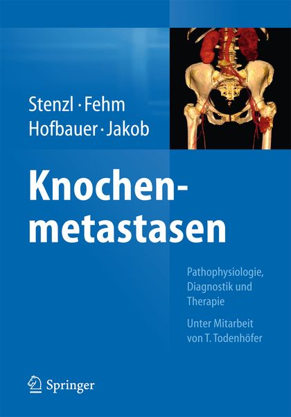 Produktbild: Knochenmetastasen