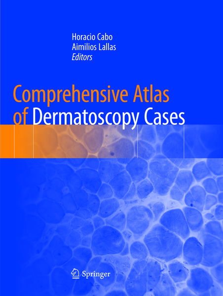 Produktbild: Comprehensive Atlas of Dermatoscopy Cases