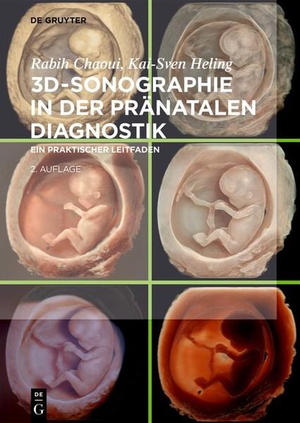 Produktbild: 3D-Sonographie in der pr&auml;natalen Diagnostik