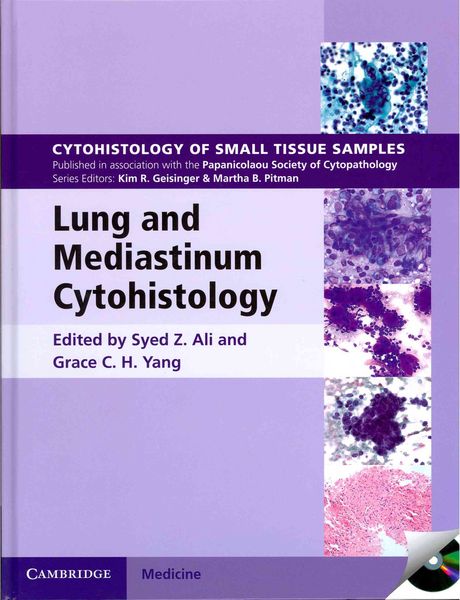 Produktbild: Lung and Mediastinum Cytohistology