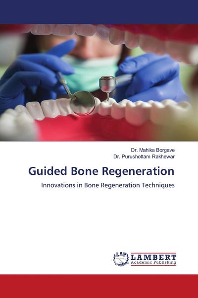 Produktbild: Guided Bone Regeneration