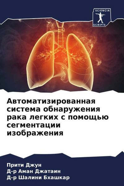 Produktbild: Awtomatizirowannaq sistema obnaruzheniq raka legkih s pomosch'&uuml; segmentacii izobrazheniq