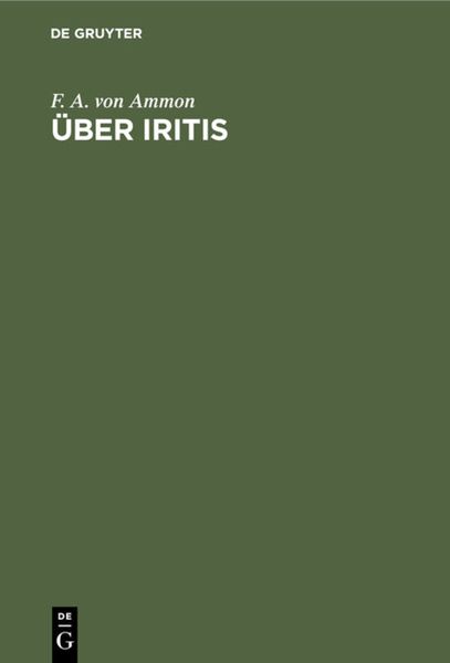 Produktbild: &Uuml;ber Iritis
