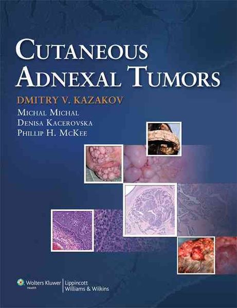 Produktbild: Cutaneous Adnexal Tumors