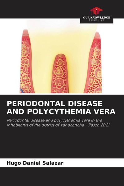 Produktbild: Periodontal Disease and Polycythemia Vera