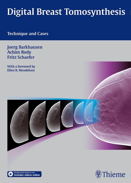 Produktbild: Digital Breast Tomosynthesis