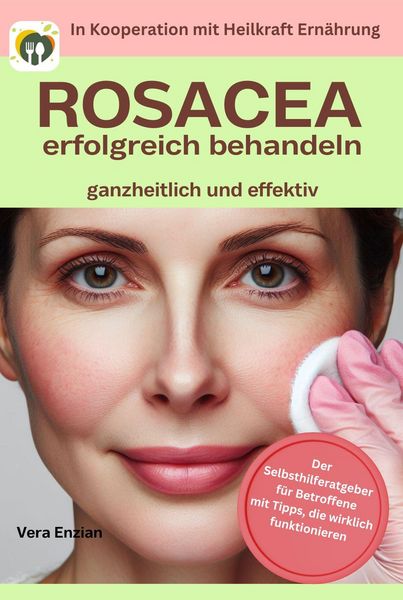 Produktbild: Rosacea erfolgreich behandeln - ganzheitlich und effektiv