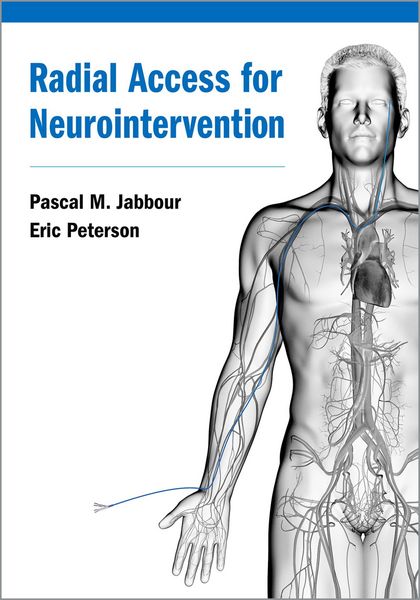 Produktbild: Radial Access for Neurointervention