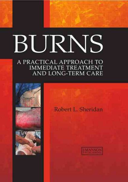 Produktbild: BURNS
