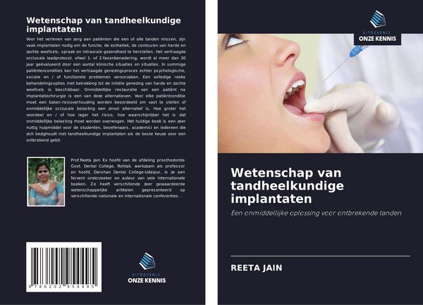 Produktbild: Wetenschap van tandheelkundige implantaten