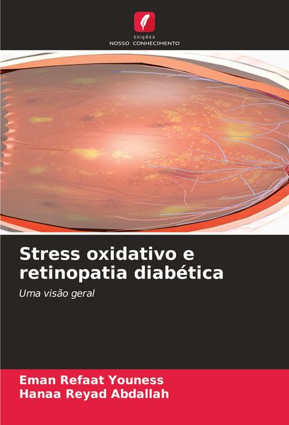 Produktbild: Stress oxidativo e retinopatia diab&eacute;tica