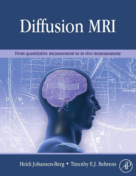 Produktbild: Diffusion MRI