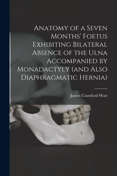 Produktbild: Anatomy of a Seven Months' Foetus Exhibiting Bilateral Absence of the Ulna Accompanied by Monadactyly (and Also Diaphragmatic Hernia) [microform]