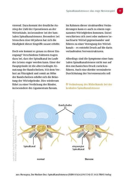 Produktbild: Der R&uuml;cken-Doc: Spinalkanalstenose