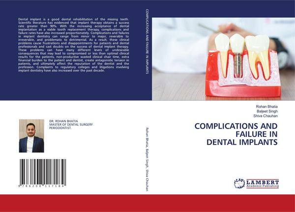 Produktbild: Complications and Failure in Dental Implants