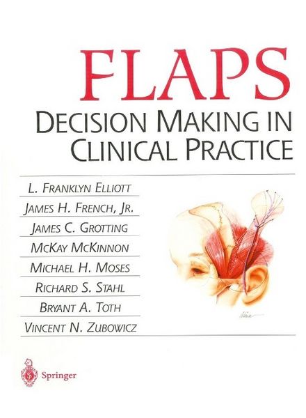 Produktbild: Flaps