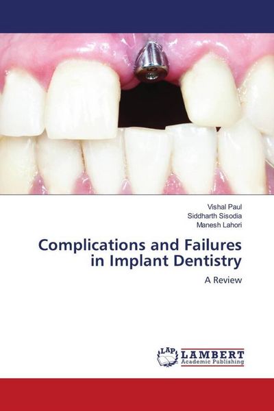 Produktbild: Complications and Failures in Implant Dentistry