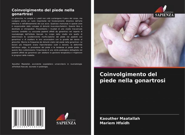 Produktbild: Coinvolgimento del piede nella gonartrosi