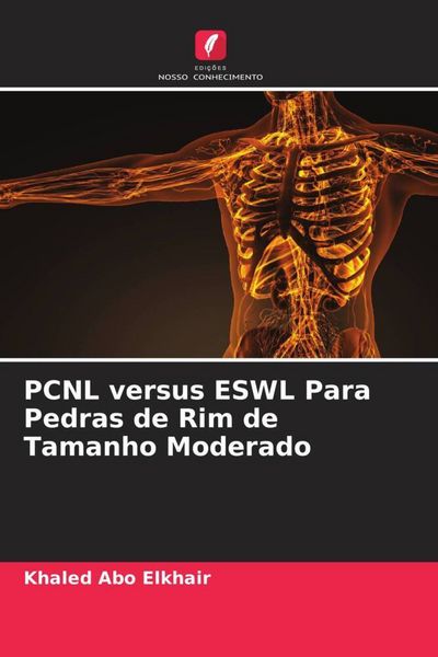 Produktbild: PCNL versus ESWL Para Pedras de Rim de Tamanho Moderado