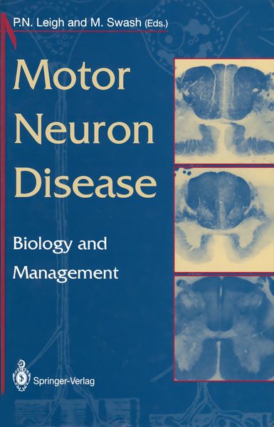 Produktbild: Motor Neuron Disease